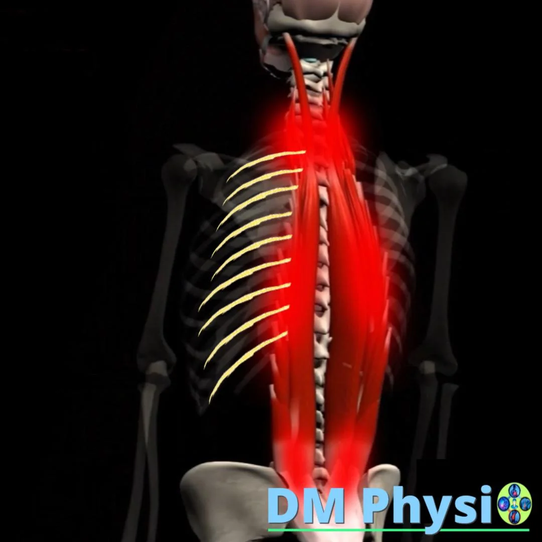 Напрежение в гръбните мускули